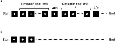 Comparison of local activation, functional connectivity, and structural connectivity in the N-back task